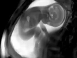 تصویری بسیار جالب از یک جنین در هفته های آخر بارداری در رحم مادر 