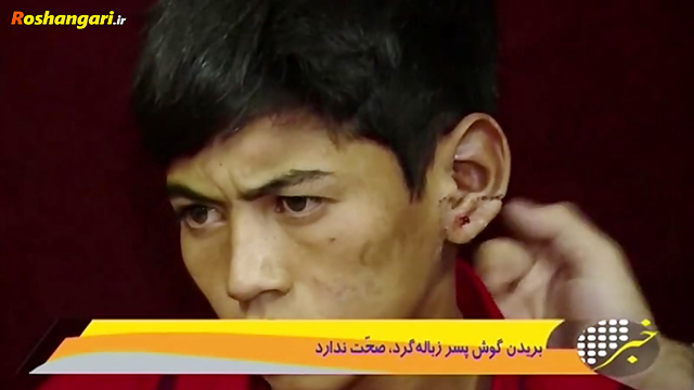 گزارش 20:30 در مورد شایعه بریده شدن گوش کودک افغان توسط شهرداری