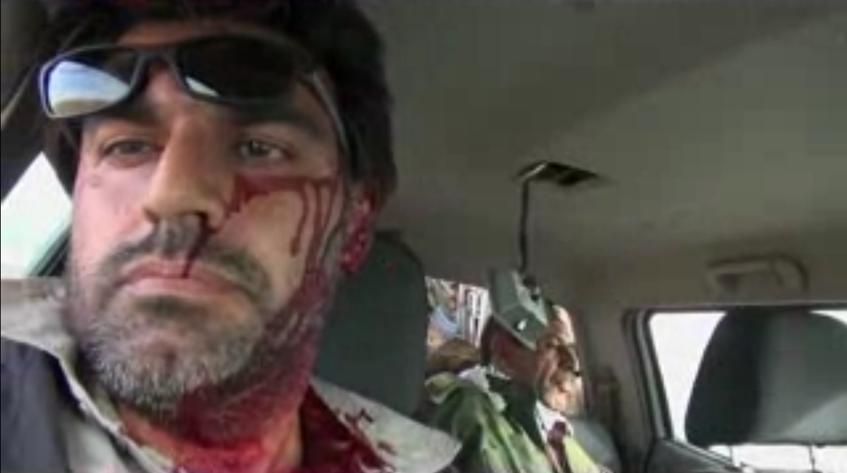 لحظه مجروحیت مستندساز ایرانی توسط داعش
