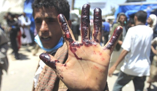 مستند «یمن زیر آتش» - بررسی ابعاد جنایت سعودی ها یمن