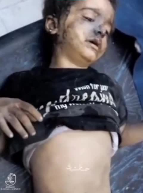 مظلومیت کودکان فلسطینی به روایت تصویر ( جنایات وحشتناک اسرائیل )